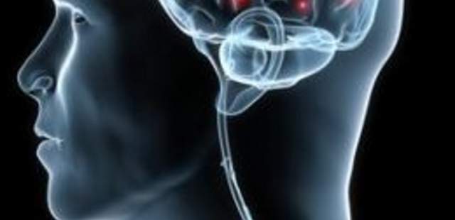 Gehirn-Wissen – Ziele erreichen Gehirn-Wissen – Ziele erreichen